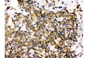 Immunohistochemistry (Paraffin-embedded Sections) (IHC (p)) image for anti-Discs, Large Homolog 4 (Drosophila) (DLG4) (AA 581-724) antibody (ABIN3043563) (DLG4 Antikörper  (AA 581-724))