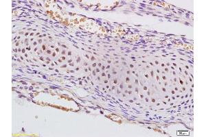 Immunohistochemistry (IHC) image for anti-Splicing Factor 3a, Subunit 2, 66kDa (SF3A2) (AA 65-160) antibody (ABIN1385973)