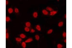 ABIN6268961 staining NIH-3T3 by IF/ICC. (Cyclin C Antikörper  (C-Term))