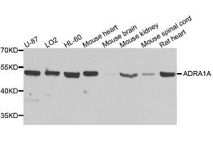 Western blot analysis of extracts of various cell lines, using ADRA1A antibody. (alpha 1 Adrenergic Receptor Antikörper  (AA 346-475))