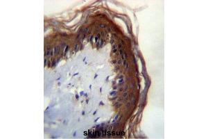 Immunohistochemistry (IHC) image for anti-Lipase, Family Member M (LIPM) antibody (ABIN2996801) (LIPM Antikörper)