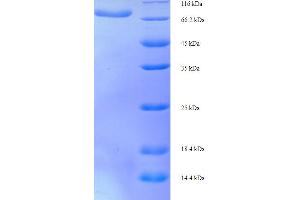 SDS-PAGE (SDS) image for D-2-Hydroxyglutarate Dehydrogenase (D2HGDH) (AA 14-521) protein (His-SUMO Tag) (ABIN5711613)