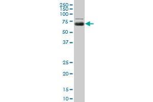 MGAT4A monoclonal antibody (M01), clone 8C5. (MGAT4A Antikörper  (AA 436-535))