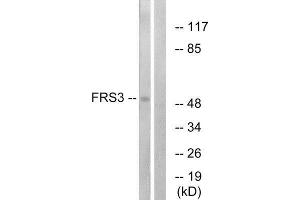 Western Blotting (WB) image for anti-Fibroblast Growth Factor Receptor Substrate 3 (FRS3) (Internal Region) antibody (ABIN1850386) (FRS3 Antikörper  (Internal Region))