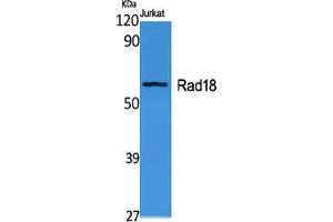 Western Blot (WB) analysis of specific cells using Rad18 Polyclonal Antibody. (RAD18 Antikörper  (Internal Region))