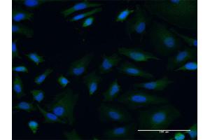 Immunofluorescence of monoclonal antibody to POLRMT on HeLa cell. (POLRMT Antikörper  (AA 1121-1230))