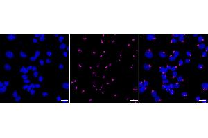 Immunocytochemical staining of Hela cells with Golgi reassembly stacking protein 1 antibody (ABIN7798795), 1:1,000). (Rekombinanter GORASP1 Antikörper)