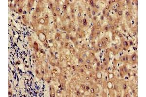 Immunohistochemistry of paraffin-embedded human liver tissue using ABIN7173617 at dilution of 1:100 (Tryptophan Hydroxylase 2 Antikörper  (AA 44-225))
