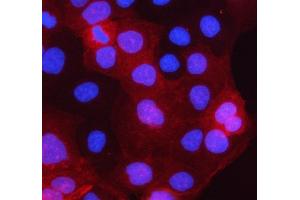 IF analysis of PCTP-L/STARD10 using anti-PCTP-L/STARD10 antibody (ABIN7599199).