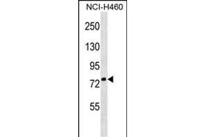 ZN Antibody (Center) (ABIN1538293 and ABIN2850013) western blot analysis in NCI- cell line lysates (35 μg/lane). (ZNF607 Antikörper  (AA 312-338))