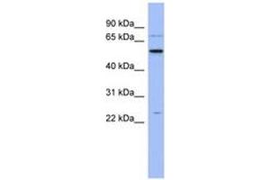 Image no. 1 for anti-Zinc Finger CCHC-Type and RNA Binding Motif 1 (ZCRB1) (N-Term) antibody (ABIN6743039) (ZCRB1 Antikörper  (N-Term))