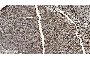 IHC analysis of Ku70 using anti-Ku70 antibody (ABIN7602791).