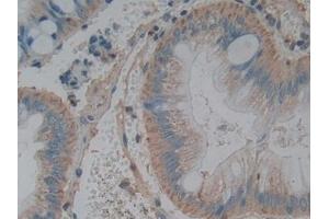Immunohistochemistry (IHC) image for anti-Tumor Necrosis Factor (Ligand) Superfamily, Member 15 (TNFSF15) (AA 67-251) antibody (ABIN7442309)