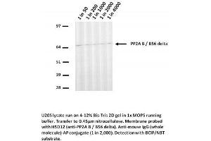 Image no. 1 for anti-Protein Phosphatase 2, Regulatory Subunit B', delta (PPP2R5D) (N-Term) antibody (ABIN1042657)
