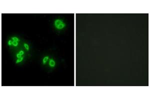 Immunofluorescence analysis of A549 cells, using TFIP8 antibody. (Cytokeratin 5 Antikörper  (Internal Region))