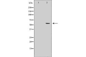 Western blot analysis of Cytochrome P450 19A1 Antibody expression in Human placenta tissue lysates. (Aromatase Antikörper  (Internal Region))