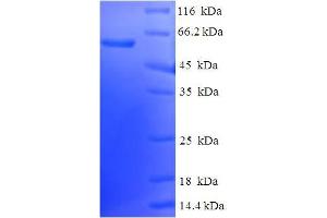 SDS-PAGE (SDS) image for Endoplasmic Reticulum Protein 44 (ERP44) (AA 30-406) protein (His-SUMO Tag) (ABIN5711749) (ERP44 Protein (AA 30-406) (His-SUMO Tag))