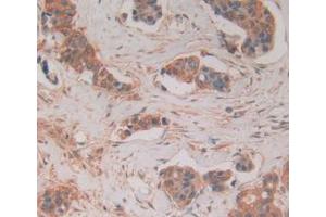 Figure. (FADD Antikörper  (AA 12-206))