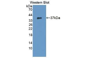 Western blot analysis of the recombinant protein. (CPSF1 Antikörper  (AA 1-300))
