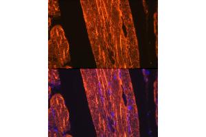 Immunofluorescence analysis of rat skeletal muscle using α-Actin-1  Rabbit mAb (ABIN3015986, ABIN3015987, ABIN1680683 and ABIN1680684) at dilution of 1:100 (40x lens). (Actin Antikörper)