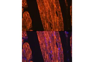 Immunofluorescence analysis of rat skeletal muscle using α-Actin-1  Rabbit mAb (ABIN3015986, ABIN3015987, ABIN1680683 and ABIN1680684) at dilution of 1:100 (40x lens).