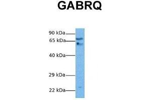 Host:  Rabbit  Target Name:  GABRQ  Sample Tissue:  Human Stomach Tumor  Antibody Dilution:  1. (GABRQ Antikörper  (N-Term))