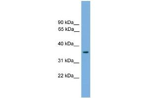 WB Suggested Anti-Foxf1a Antibody Titration: 0. (FOXF1 Antikörper  (Middle Region))