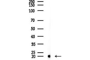 anti-Ubiquitin-Conjugating Enzyme E2D 2 (UBE2D2) (C-Term) antibody