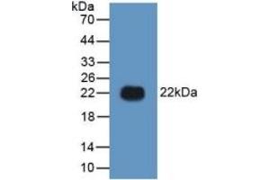 WB of Protein Standard: different control antibodies against Highly purified E. (HMGB1 ELISA Kit)