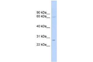 MRPL13 antibody used at 1 ug/ml to detect target protein. (MRPL13 Antikörper  (Middle Region))