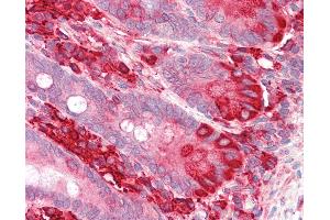 Anti-TXNDC5 / ERP46 antibody IHC staining of human small intestine. (TXNDC5 Antikörper  (AA 419-432))