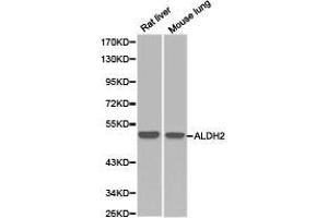 Western Blotting (WB) image for anti-Aldehyde Dehydrogenase 2 Family (Mitochondrial) (ALDH2) antibody (ABIN1870925)