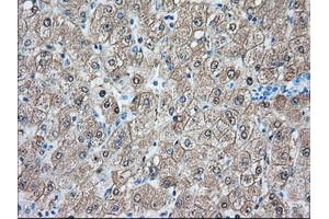 Immunohistochemical staining of paraffin-embedded Human prostate tissue using anti-BHMT mouse monoclonal antibody. (BHMT Antikörper)
