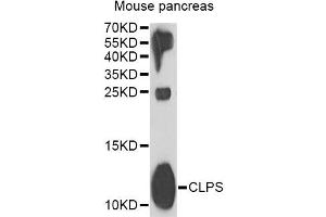 Western blot analysis of extracts of mouse pancreas, using CLPS antibody (ABIN2561908) at 1:1000 dilution. (CLPS Antikörper)
