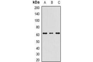 Western blot analysis of RIPK2 expression in MCF7 (A), mouse spleen (B), mouse testis (C) whole cell lysates. (RIPK2 Antikörper)