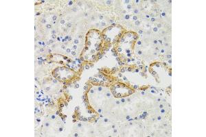 Immunohistochemistry of paraffin-embedded rat kidney using SH2B1 Antibody. (SH2B1 Antikörper)