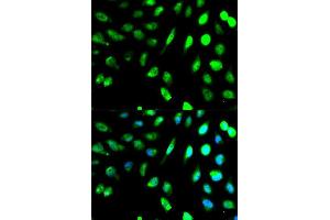 Immunofluorescence analysis of MCF7 cell using KLRD1 antibody. (CD94 Antikörper  (AA 32-179))