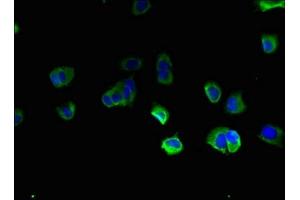 Immunofluorescent analysis of MCF-7 cells using ABIN7171610 at dilution of 1:100 and Alexa Fluor 488-congugated AffiniPure Goat Anti-Rabbit IgG(H+L) (TBC1D2 Antikörper  (AA 1-237))