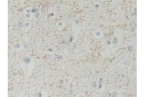 Immunohistochemistry (IHC) image for anti-Flavin Reductase (BLVRB) (AA 2-206) antibody (ABIN7441571)