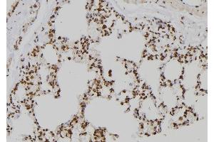 ABIN6258363 and ABIN6273562 at 1/100 staining Rat lung tissue by IHC-P. (ZNF440 Antikörper  (C-Term))