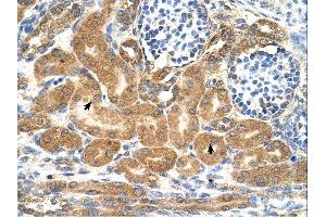 TMEM69 antibody was used for immunohistochemistry at a concentration of 4-8 ug/ml. (TMEM69 Antikörper  (Middle Region))