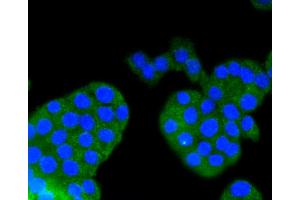 Immunofluorescence analysis of PC-12 cells using ARRB1 antibody (ABIN5996907). (beta Arrestin 1 Antikörper)