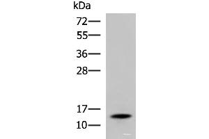 Western blot analysis of Mouse serum using TTR Polyclonal Antibody at dilution of 1:600 (TTR Antikörper)