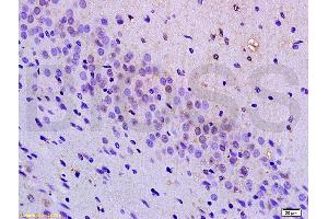 Immunohistochemistry (IHC) image for anti-POU Domain, Class 4, Transcription Factor 1 (POU4F1) (AA 325-419) antibody (ABIN702400)