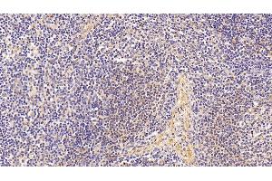 Immunohistochemistry (IHC) image for anti-Elastin (ELN) (AA 392-645) antibody (ABIN7433489)