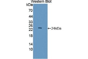 Detection of Recombinant ASCL1, Human using Polyclonal Antibody to Achaete Scute Complex Like Protein 1 (ASCL1) (Achaete Scute Complex Like Protein 1 (AA 84-236) Antikörper)