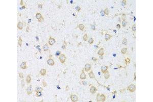Immunohistochemistry of paraffin-embedded Mouse brain using COTL1 Polyclonal Antibody at dilution of 1:100 (40x lens).
