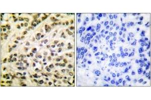 Immunohistochemistry (IHC) image for anti-Friend Leukemia Virus Integration 1 (FLI1) (AA 291-340) antibody (ABIN2889198) (FLI1 Antikörper  (AA 291-340))