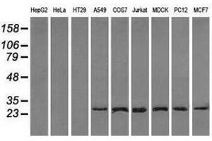Image no. 4 for anti-Replication Protein A2, 32kDa (RPA2) antibody (ABIN1500735)