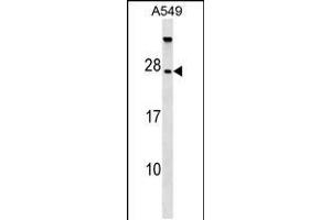 Western blot analysis in A549 cell line lysates (35ug/lane). (TBC1D28 Antikörper  (AA 48-77))